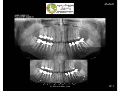 opg-image