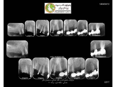 opg-image
