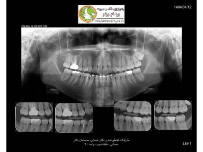 opg-image