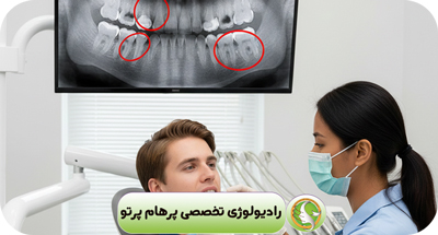 گرافی بایت‌وینگ | تشخیص دقیق پوسیدگی بین دندانی با رادیولوژی دیجیتال