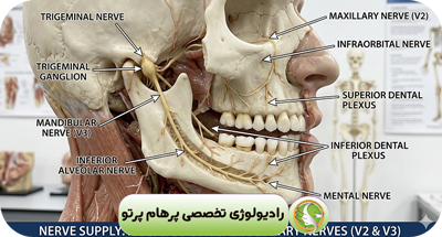 تحلیل استخوان فک قبل از ایمپلنت با CBCT | بررسی دقیق تراکم و حجم استخوان